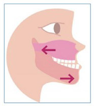 Traitements orthodontiques